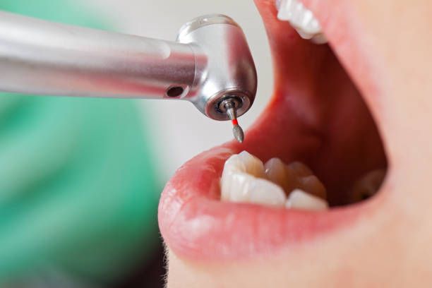 Best Emergency Dentist for Knocked-Out Tooth in Kitty Hawk, NC